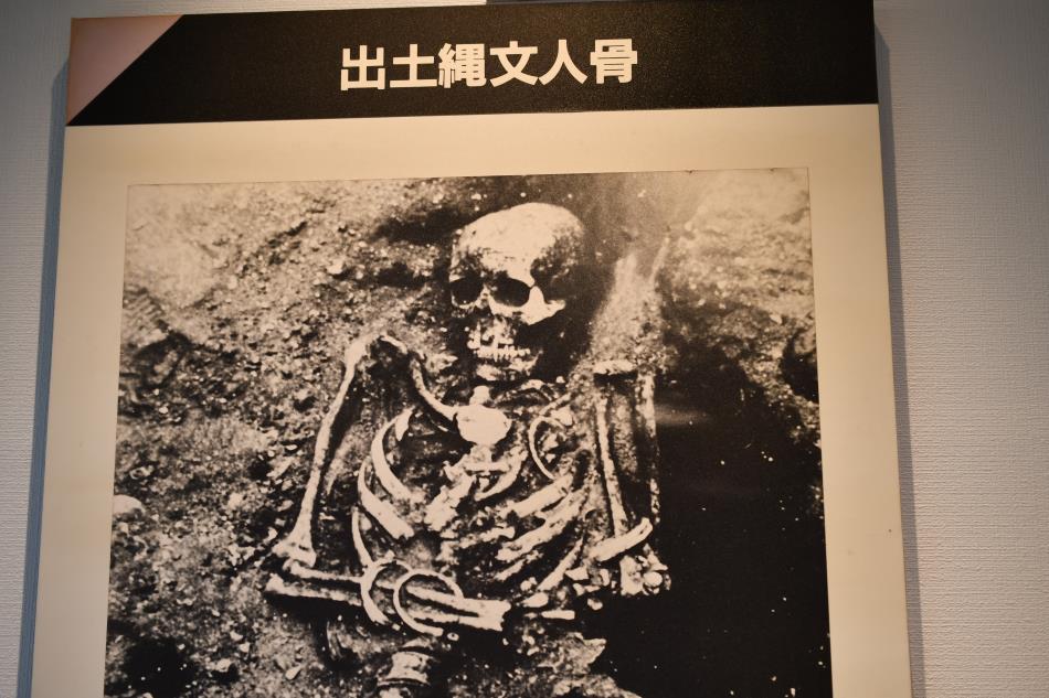 沖ノ原遺跡　出土した縄文人骨